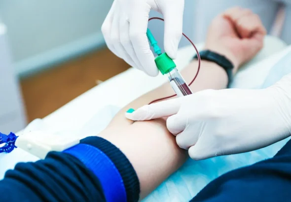 Laboratory technician handling a blood sample for multi-cancer screening test