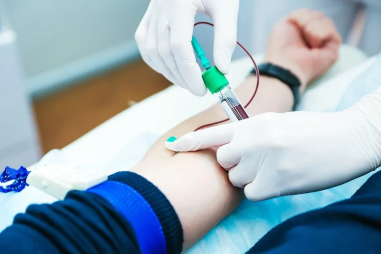 Laboratory technician handling a blood sample for multi-cancer screening test